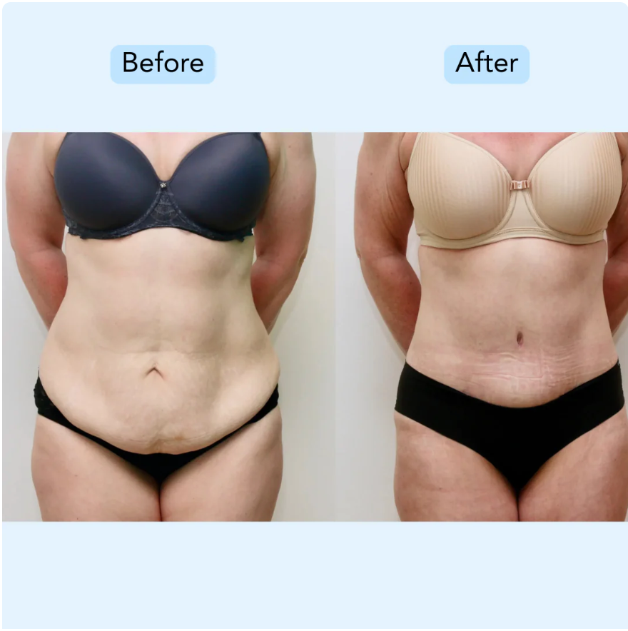 Swift Sweat™ Waist Trimmer Belt
