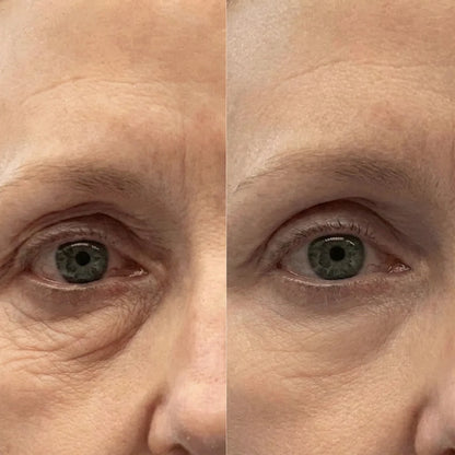 VoluGlow™ Silk Peptide Lift System